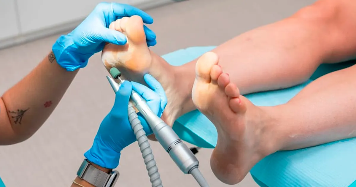 Descripción de la imagen panorámica